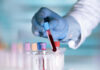 Pentagon Research Halted Over Aborted Tissue Gloved hand holding a test tube with blood.