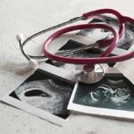 Abortion Action Allegedly DELAYED Until After Midterms Stethoscope on ultrasound photos