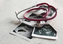 Abortion Action Allegedly DELAYED Until After Midterms Stethoscope on ultrasound photos